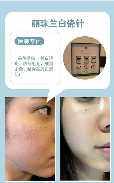 Rejuran Tone-up Booster 麗珠蘭白瓷針: -4 Rejuran Tone-up Booster 麗珠蘭白瓷針: -4