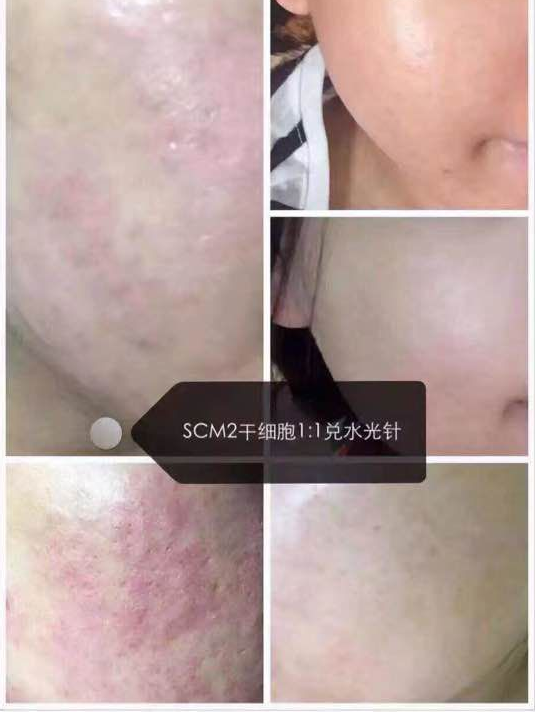 SCM2干细胞 : -7 SCM2干细胞 : -7