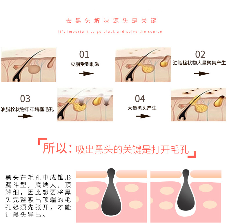 韩国进口小气泡一代 : -5