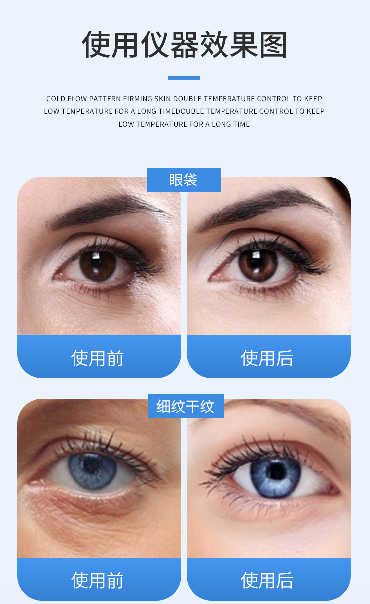 日本の血糖値計：-9