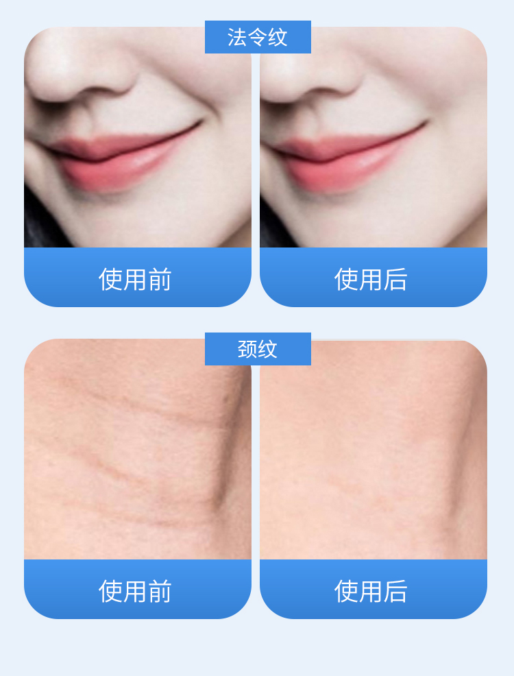 日本の血糖値計：-10