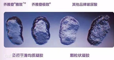 Juvederm 乔雅登 HYLACROSS技术是指使用高浓度的玻尿酸在高度交联的工艺下生产出均质的不含颗粒的凝胶,并使其具有了高度凝聚性的三维立体结构。