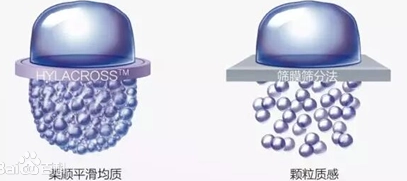 HYLACROSS technology refers to the use of high-concentration hyaluronic acid in a highly cross-linked process to produce a homogeneous, particle-free gel that has a highly cohesive three-dimensional structure.
