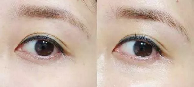 第三重功效：