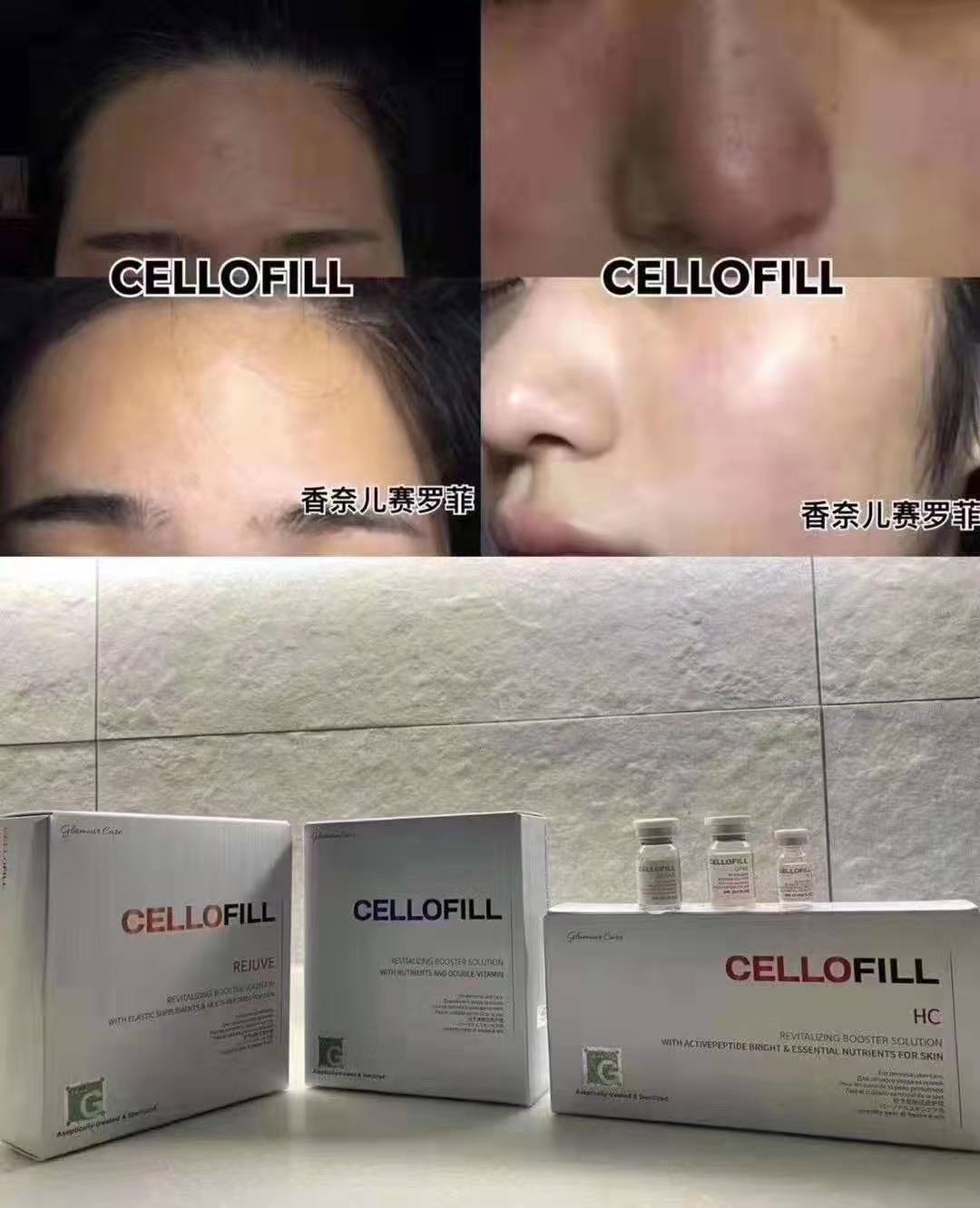 韩国的“全智贤水光”——香奈儿塞罗菲CELLOFILL GP60（又音译赛洛菲）
