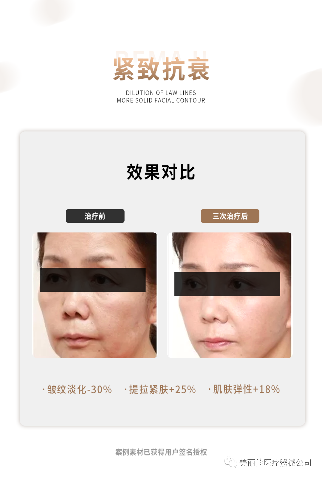 01 Product Introduction
