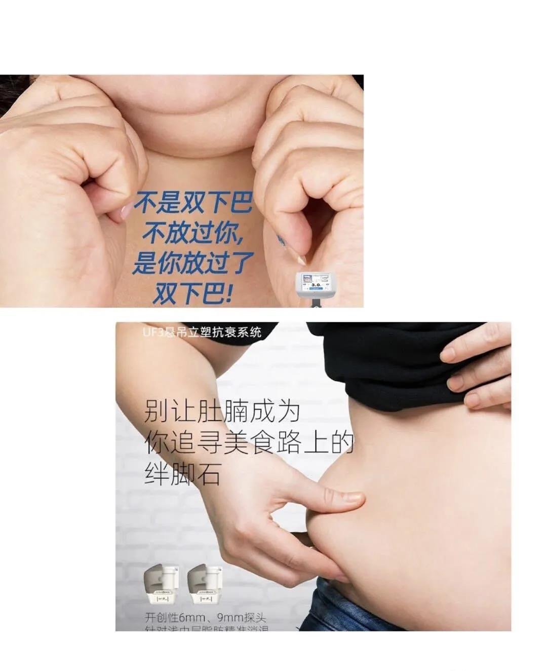 采用MMFU最新技术的7D聚拉提是一款非入侵式的对肌肤有提升紧致作用的仪器。它能够通过非手术治疗最大效能地提升面部，紧致塑造身体轮廓，具备非凡的临床效果。