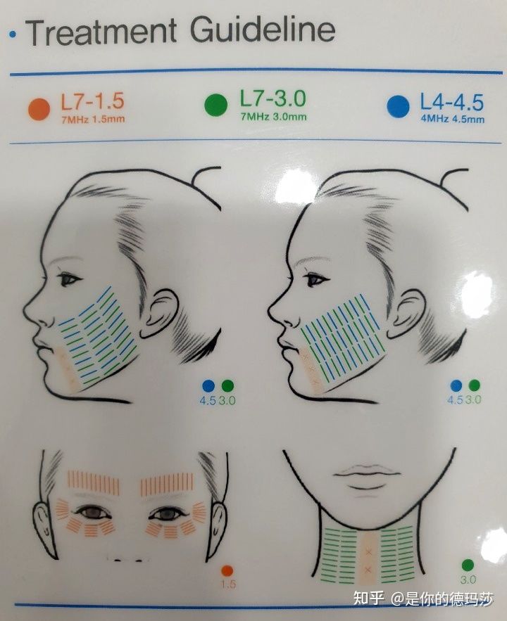 【科普】韩版7D聚拉提的使用方法以及注意事(SHURINK LIFTING LASER) : -4 【科普】韩版7D聚拉提的使用方法以及注意事(SHURINK LIFTING LASER)-广州沐凝生物科技有限公司