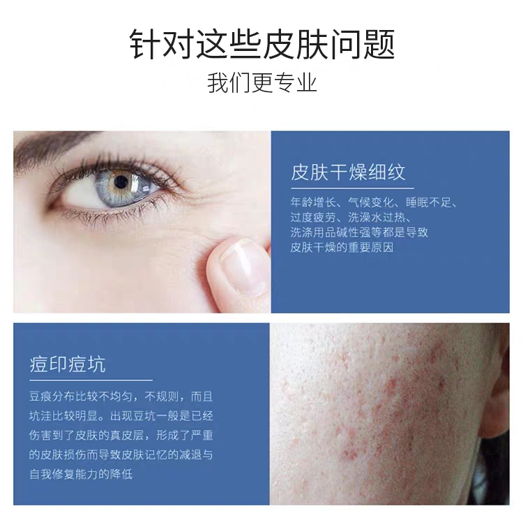 MTS second generation microneedle imported from South Korea-Guangzhou Muning Biotechnology Co., Ltd.