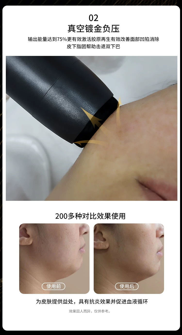 Sp 黑金刚立式超声波面部提拉美容仪