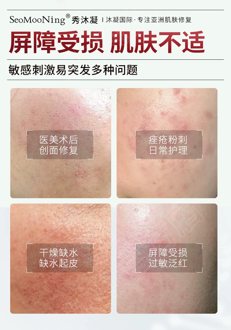 Seomooning 秀沐凝 修复霜