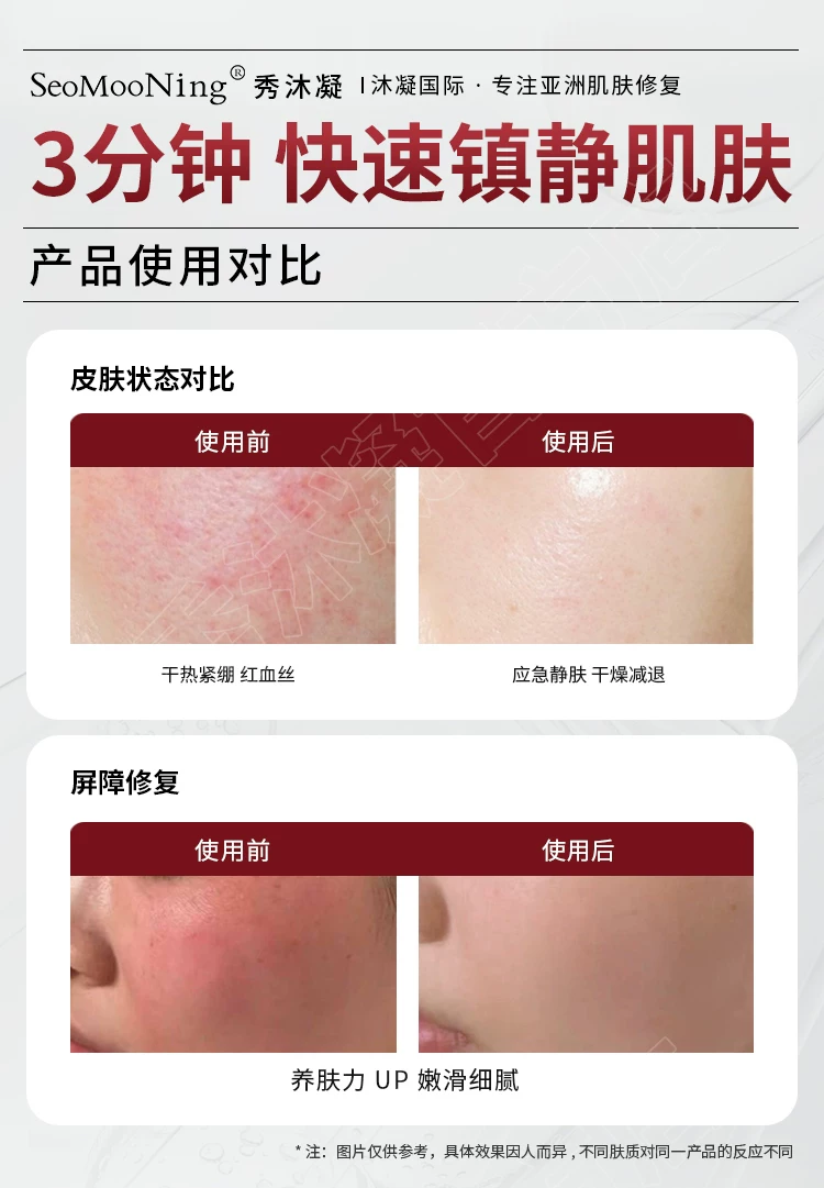 seomooning Redness-Relief Mask