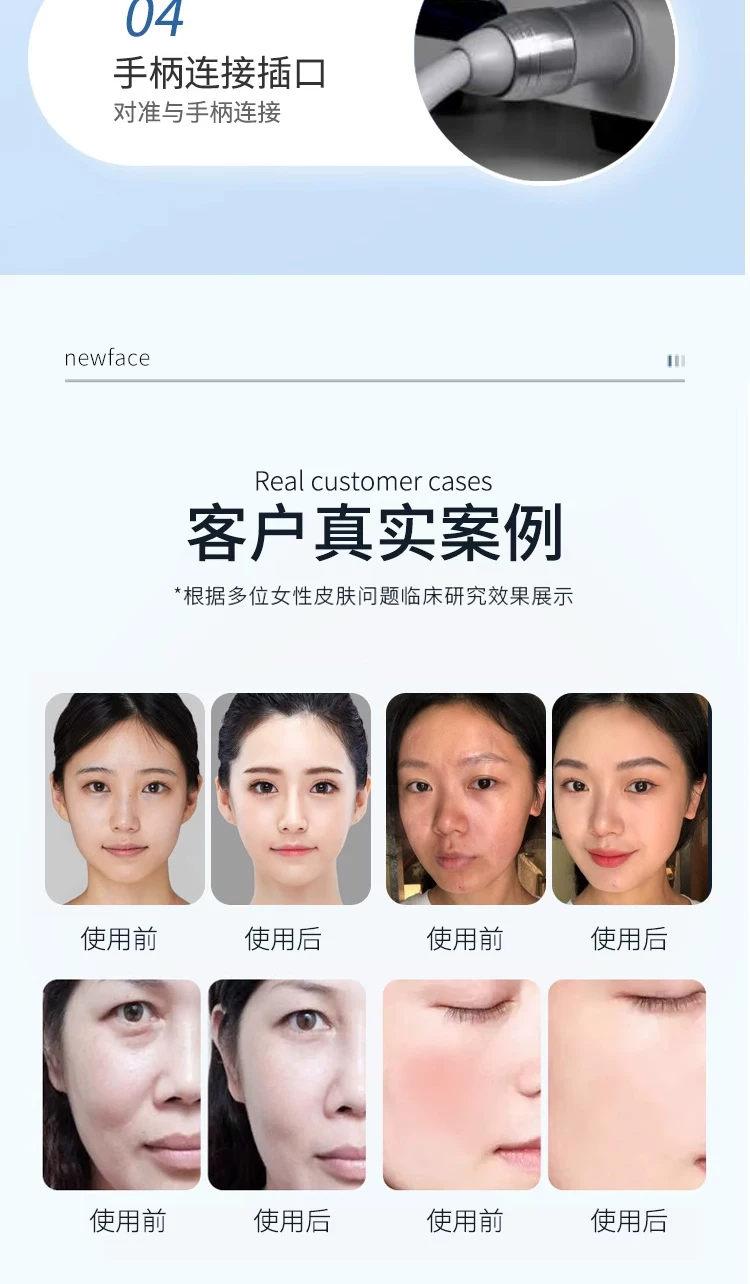 Non-Invasive Skin Hydration Device