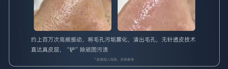 HC Seoul Ultra-Cleansing Whitening Hydro Bubble Multifunction Beauty Device