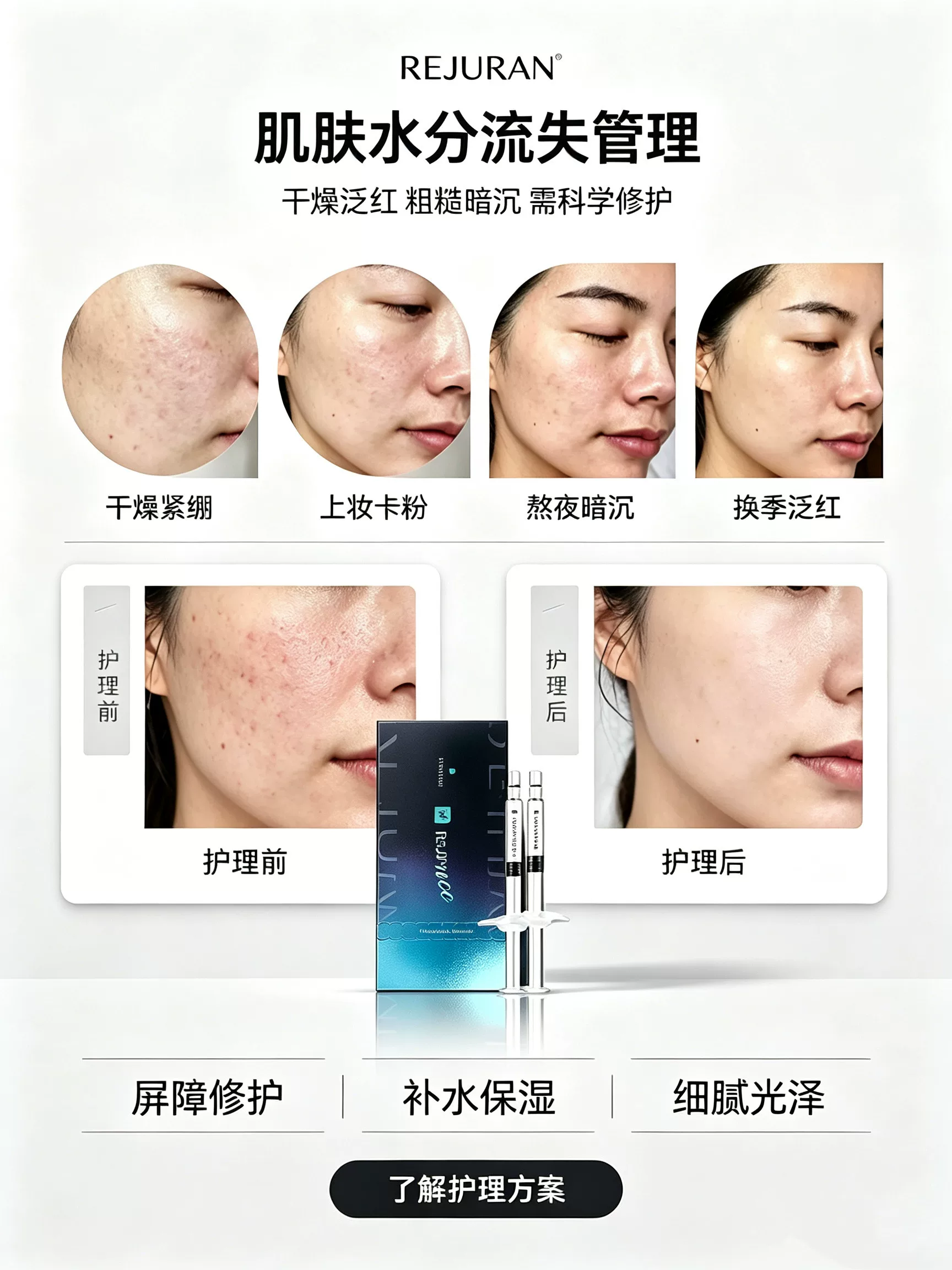 Rejuran 丽珠兰 黑盒