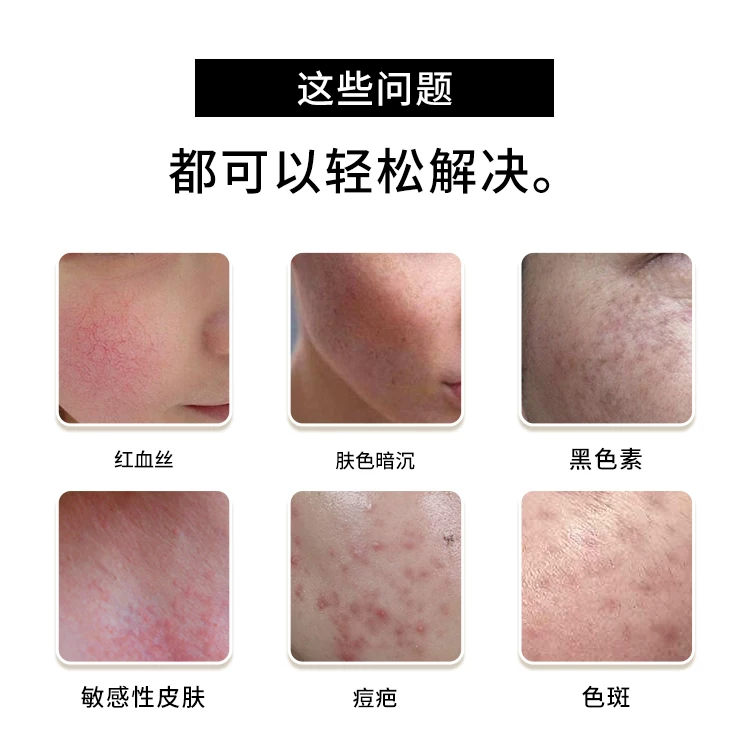 Sp 黑金刚立式超声波面部提拉美容仪