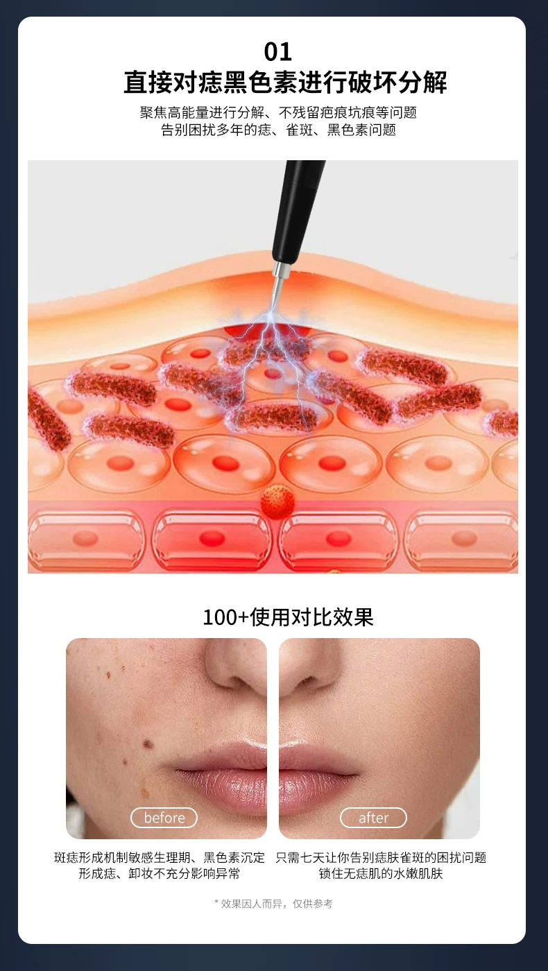 HC Seoul Skin Cleansing Device