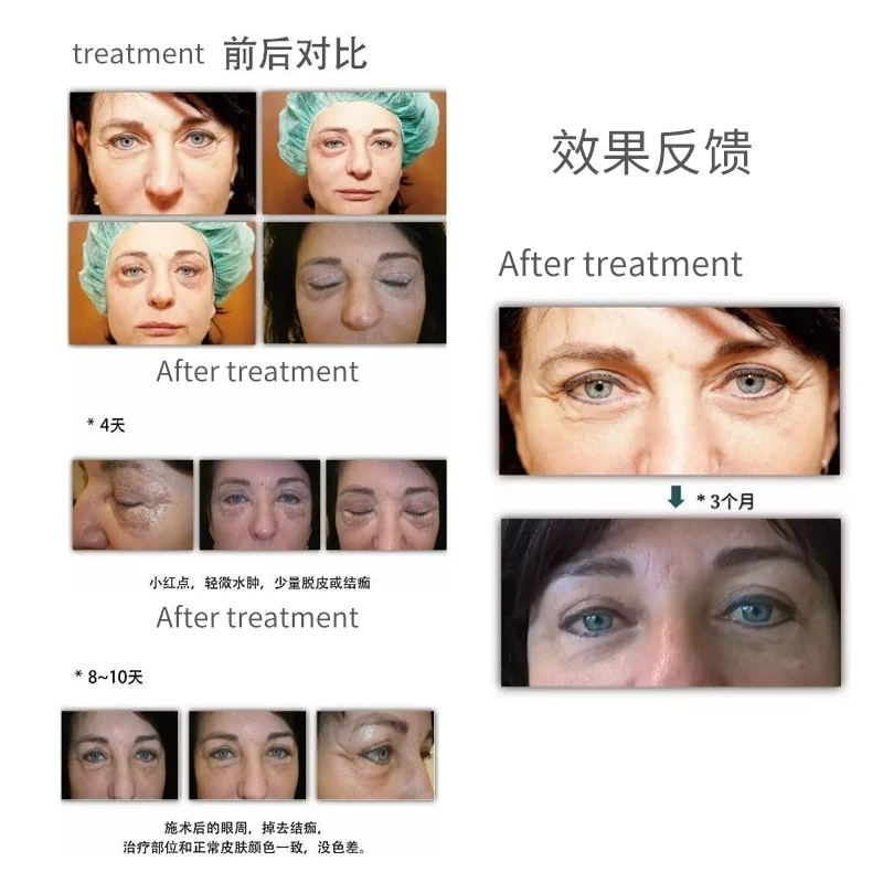 MASTER LUX PRO 2-in-1 Plasma Beauty Device