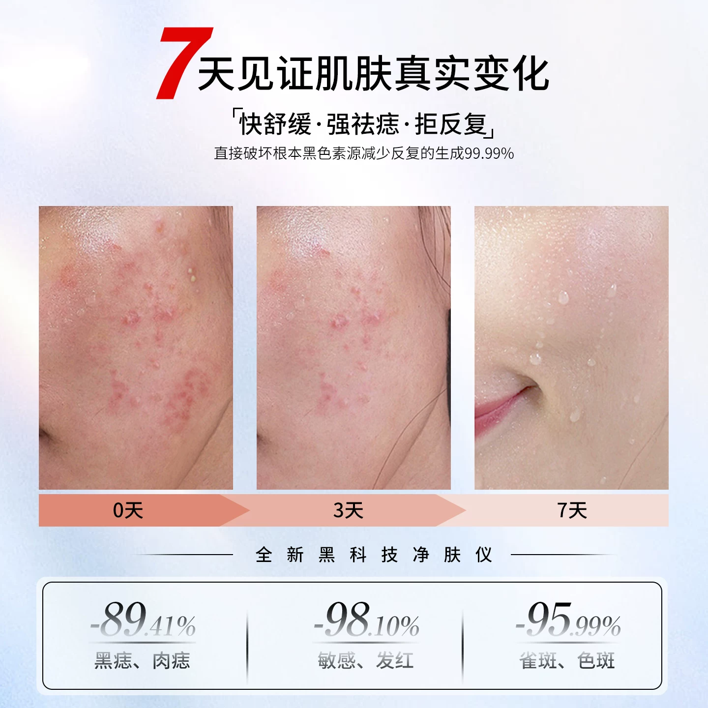 HC Seoul Skin Cleansing Device