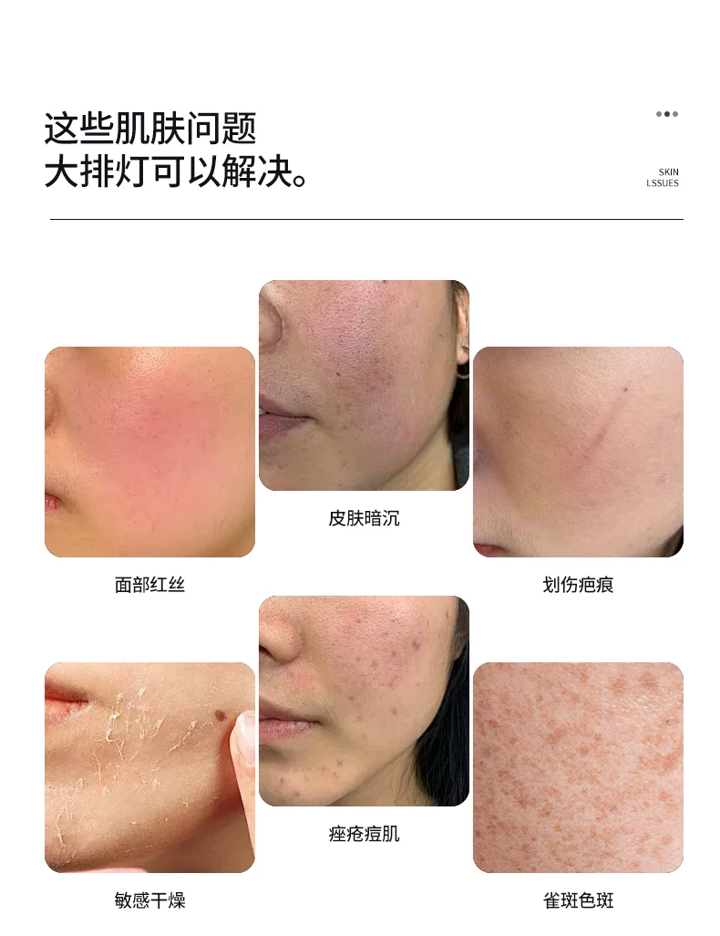 Hcfashion Photon Skin Rejuvenation Device