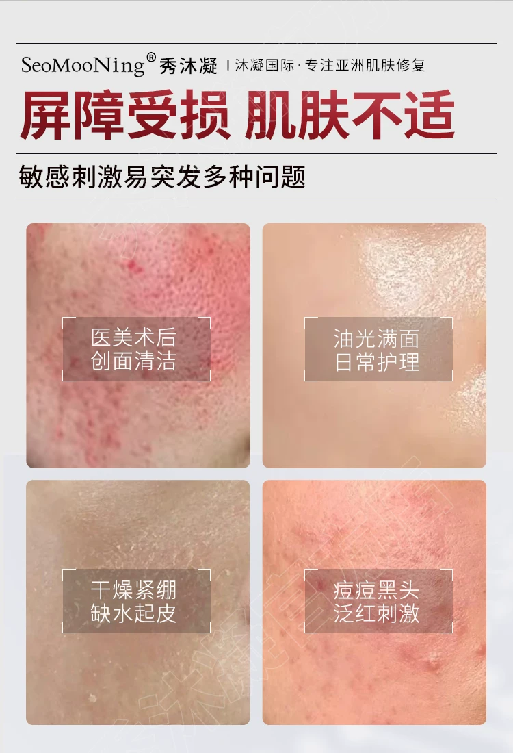 秀沐凝净颜氨基酸温和洁面乳深层清洁温和控油祛痘洁面乳术后专用
