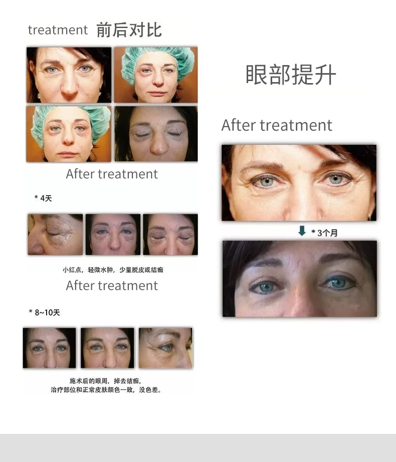 MASTER LUX PRO 2-in-1 Plasma Beauty Device