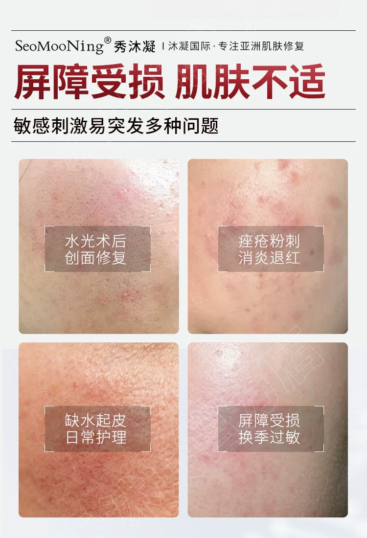 seomooning Redness-Relief Mask