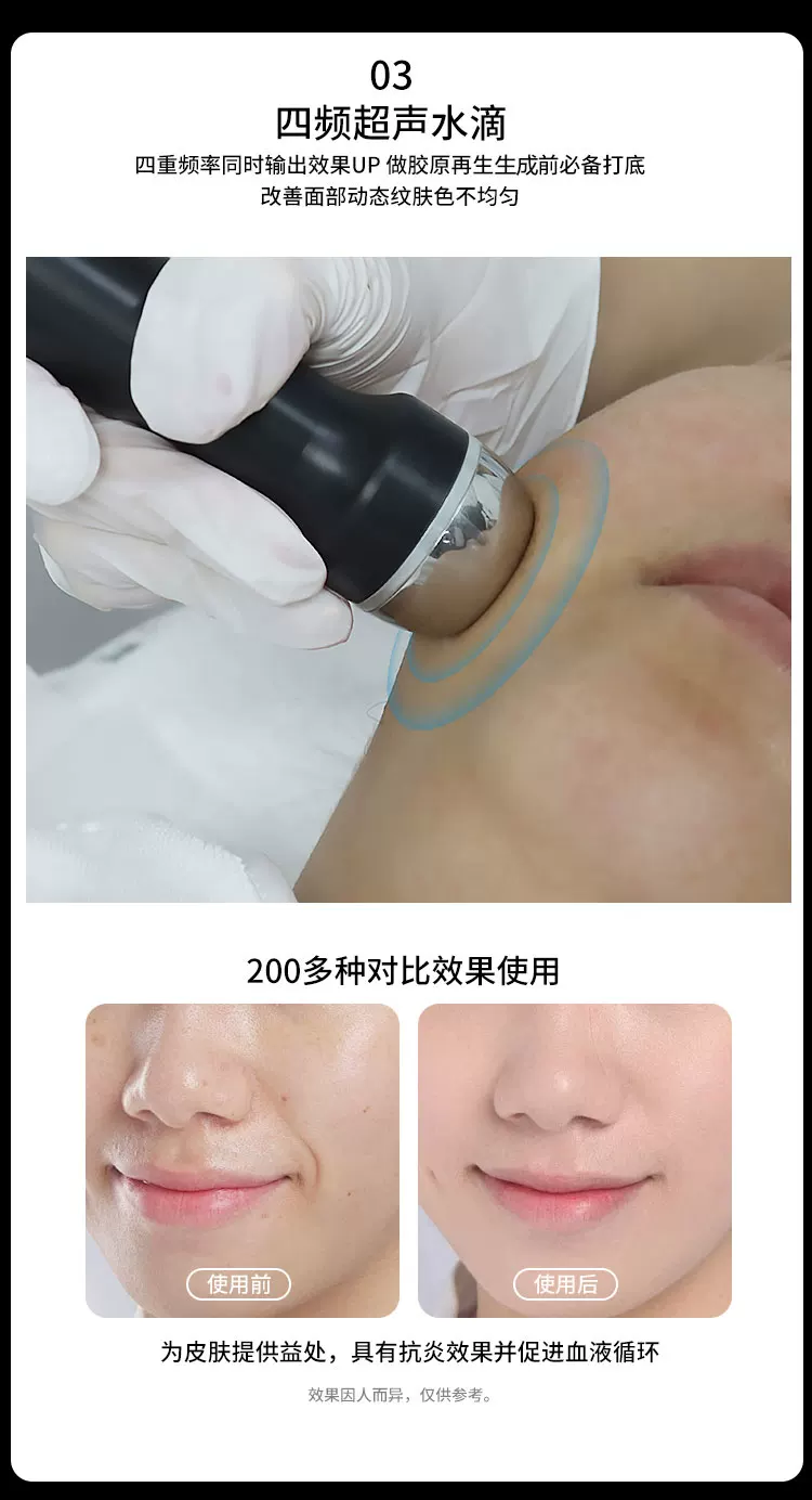 Sp 黑金刚立式超声波面部提拉美容仪