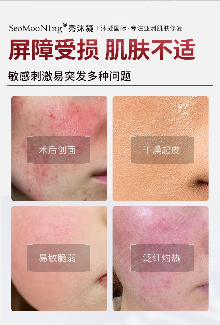 Seomooning 秀沐凝 精华液