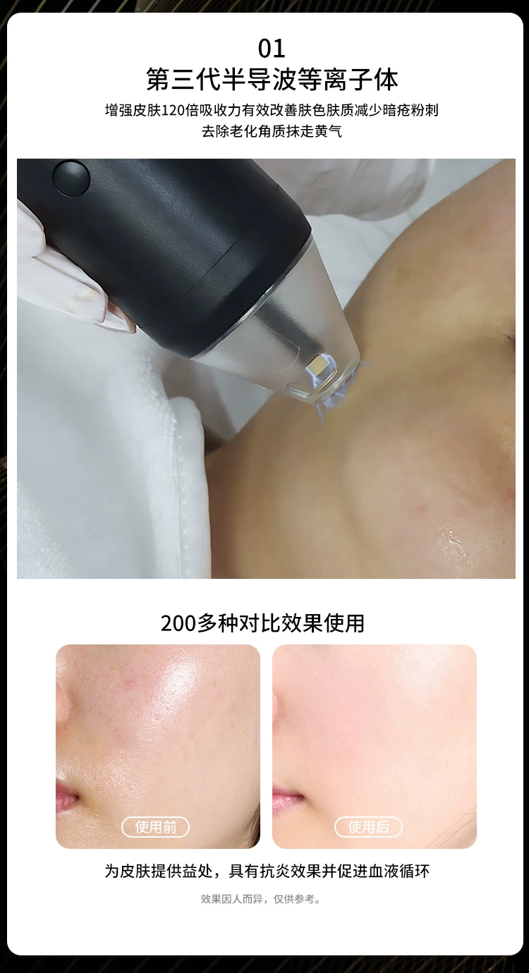 Sp 黑金刚立式超声波面部提拉美容仪