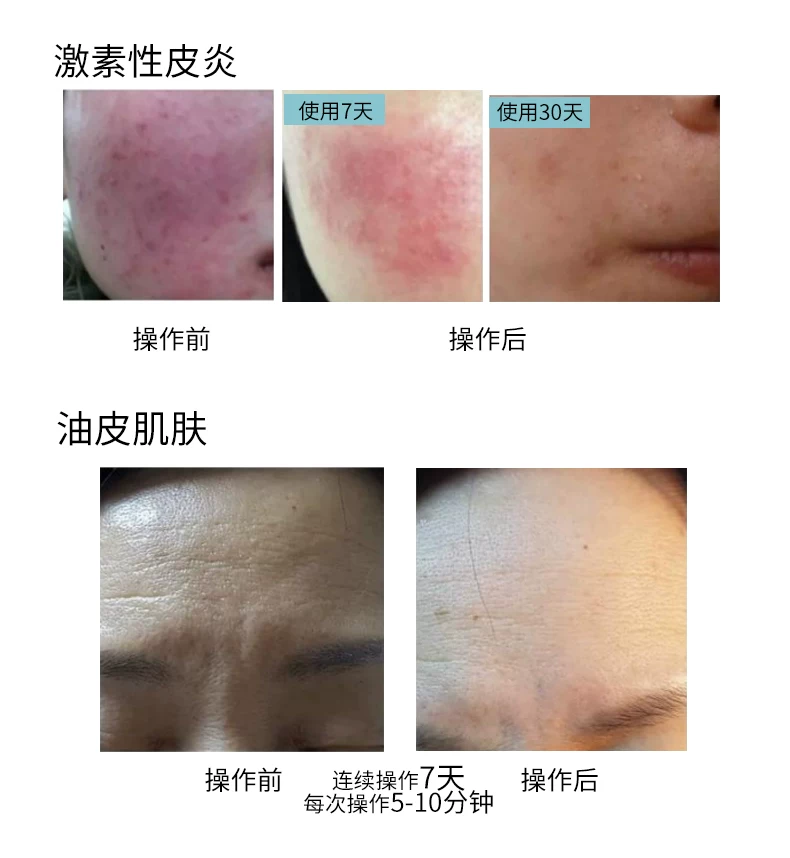 MASTER LUX PRO 2-in-1 Plasma Beauty Device