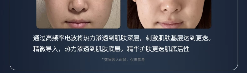 HC Seoul Ultra-Cleansing Whitening Hydro Bubble Multifunction Beauty Device