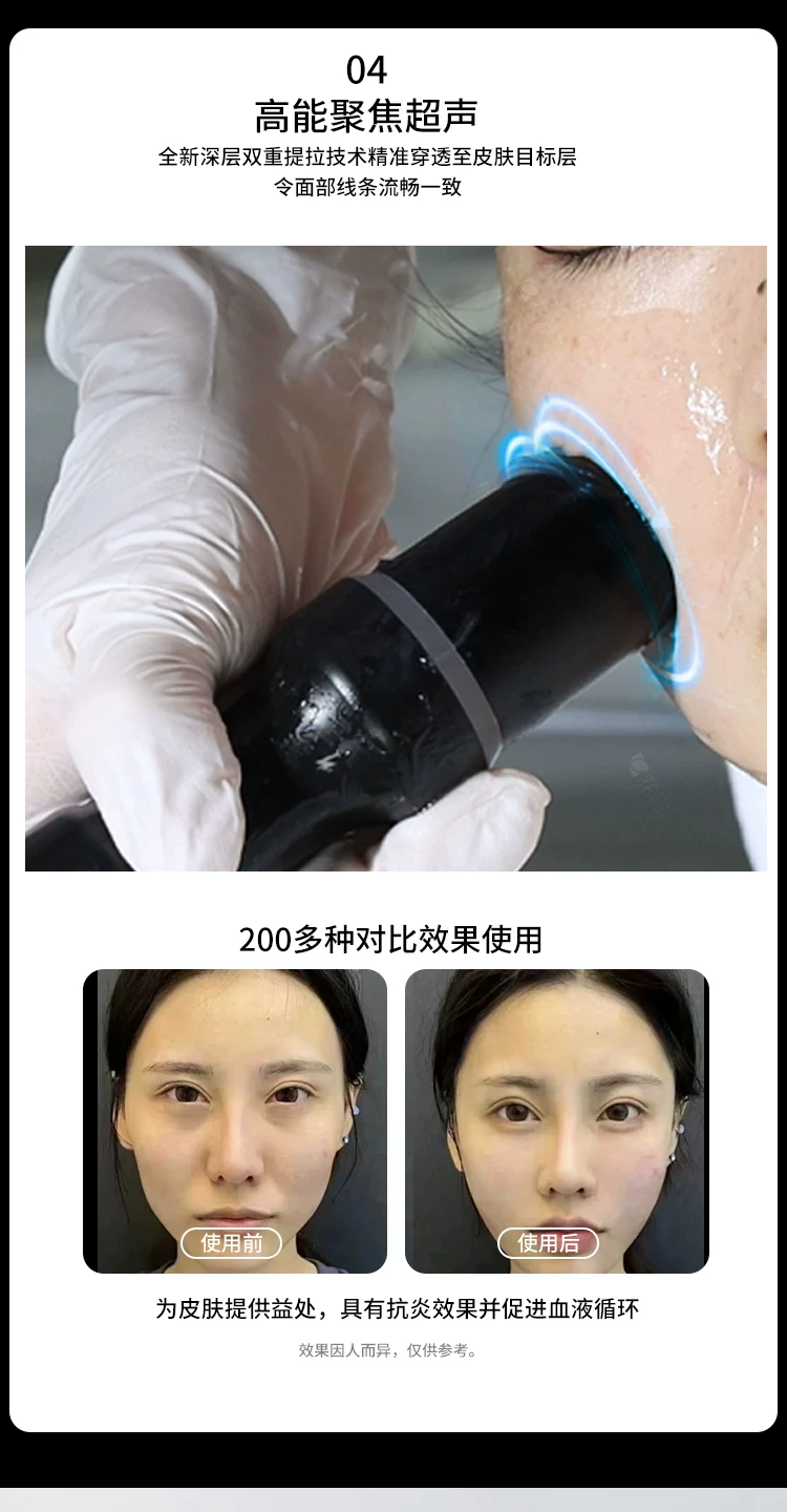 Sp 黑金刚立式超声波面部提拉美容仪