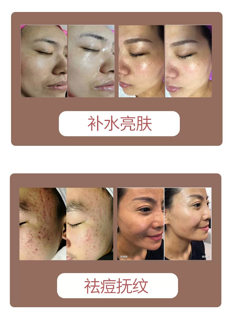 Skin Booster Machine