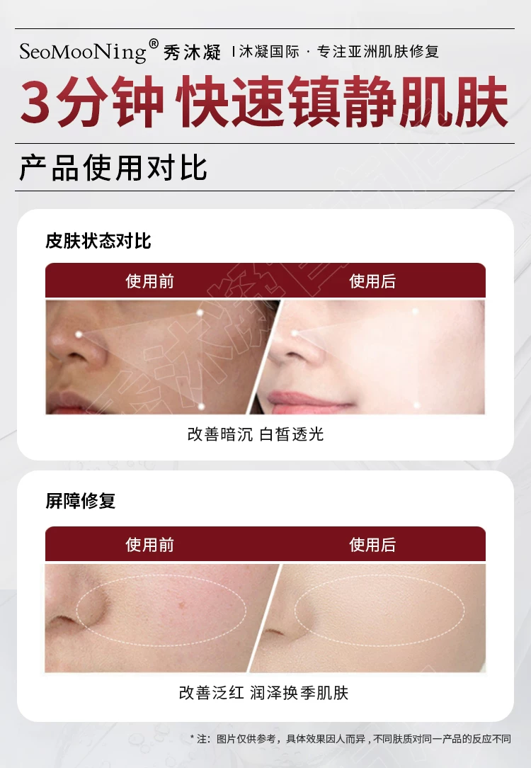 Seomooning 秀沐凝 精华液