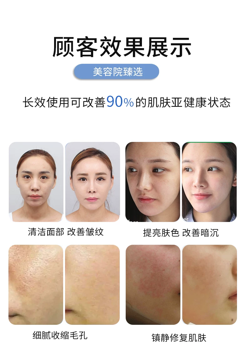 AXXZIA Japanese Needle-Free All-in-One Hydra Facial Device